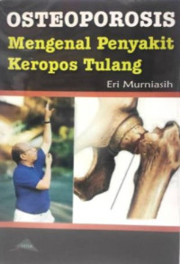Osteoporosis: Mengenal Penyakit Keropos Tulang